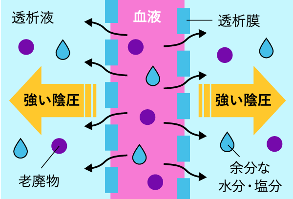 HDFの仕組み